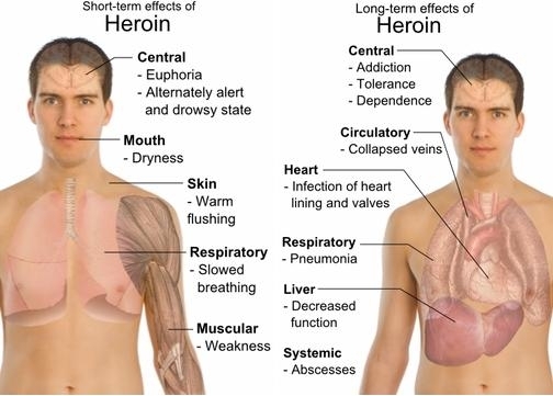 heroin effects