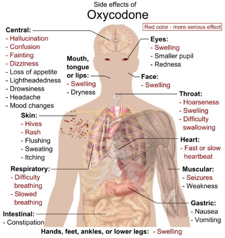 http://upload.wikimedia.org/wikipedia/commons/thumb/f/f7/side_effects_of_oxycodone.png/440px-side_effects_of_oxycodone.png