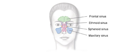 sinus types: frontal, ethmoid, sphenoid and maxillary